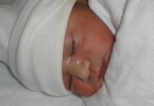 Los bebés con COVID-19 tienden a tener una enfermedad leve apenas con fiebre