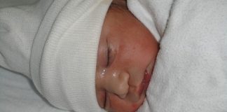 Los bebés con COVID-19 tienden a tener una enfermedad leve apenas con fiebre